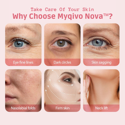 Myqivo Nova™